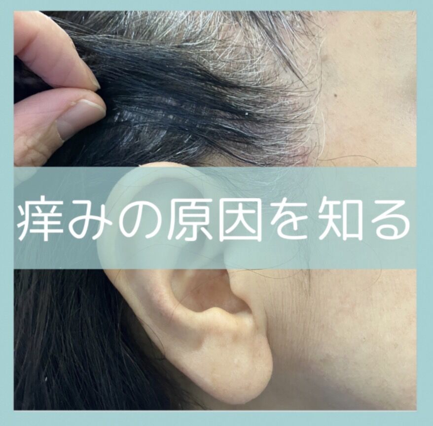 頭皮のかゆみの原因とは？美容師が教える正しい対処法と安心できるカラー施術｜河内長野市 河洋美容室