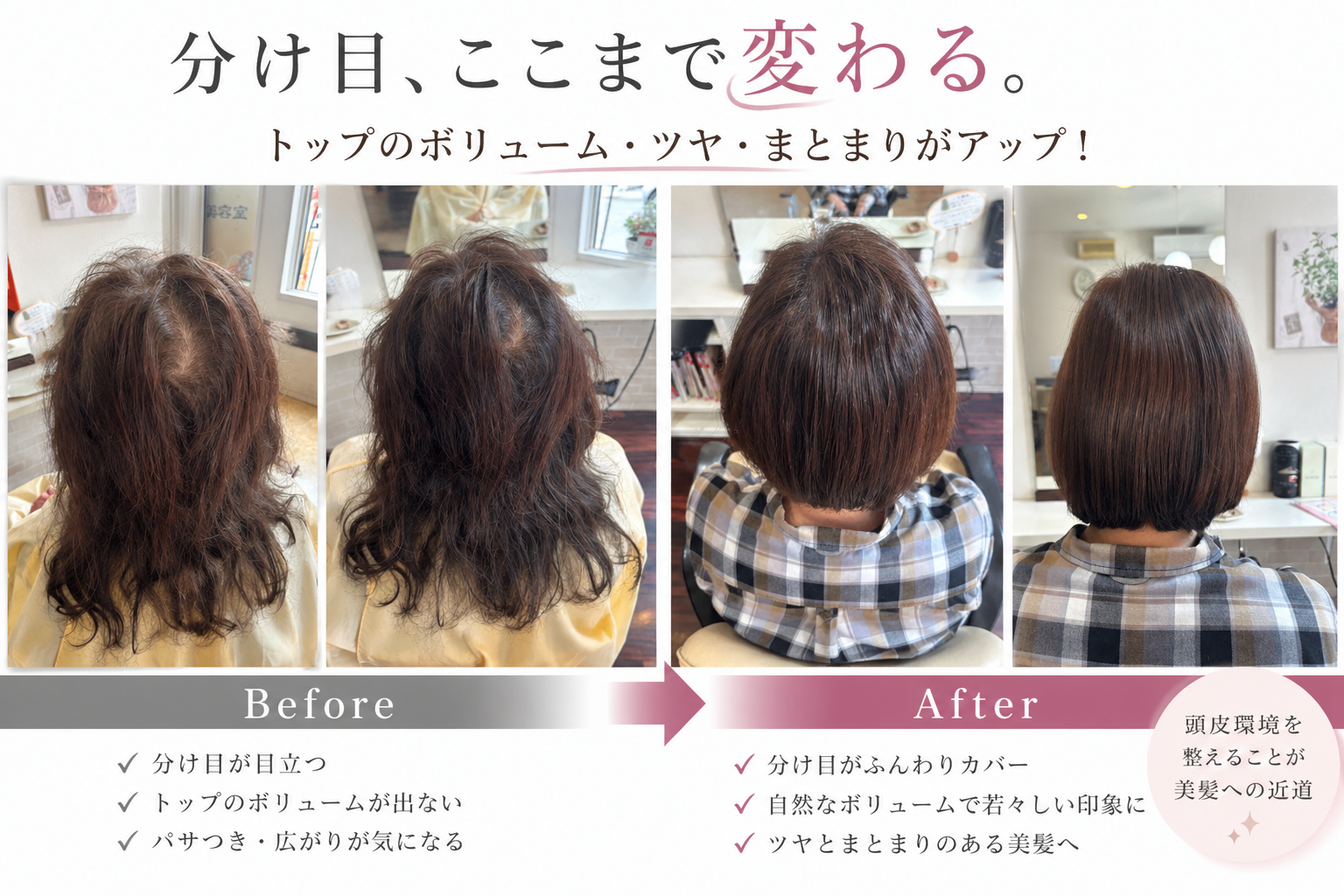 薄毛・抜け毛に悩む女性が増加中｜これからの美容室に求められる“頭皮ケア”という役割