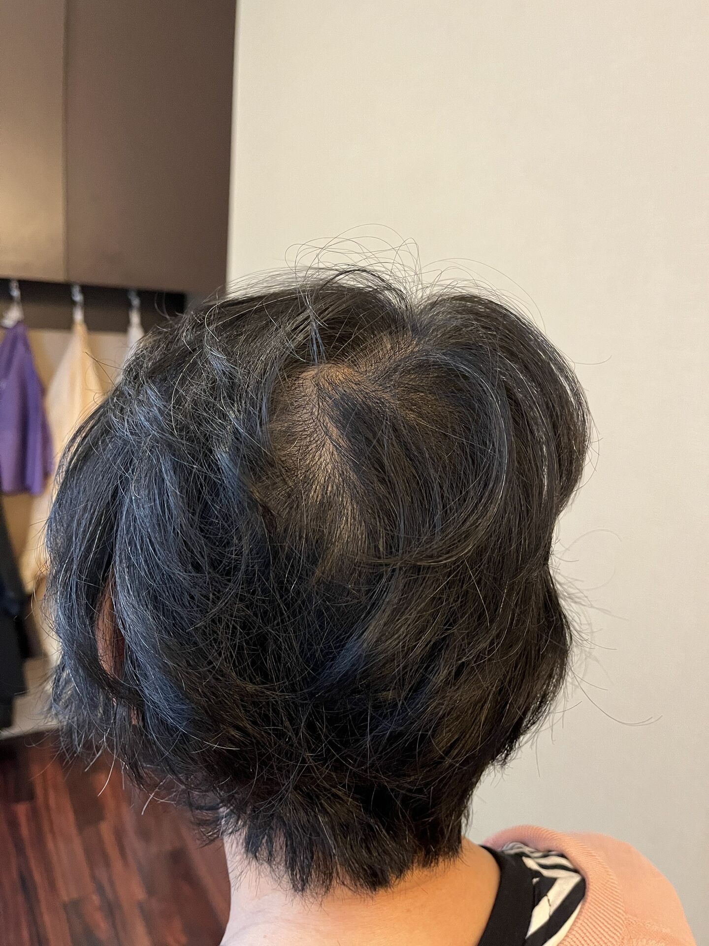 やせ髪の原因は？40代から髪が細くなる理由と改善方法を美容師が解説｜河内長野市
