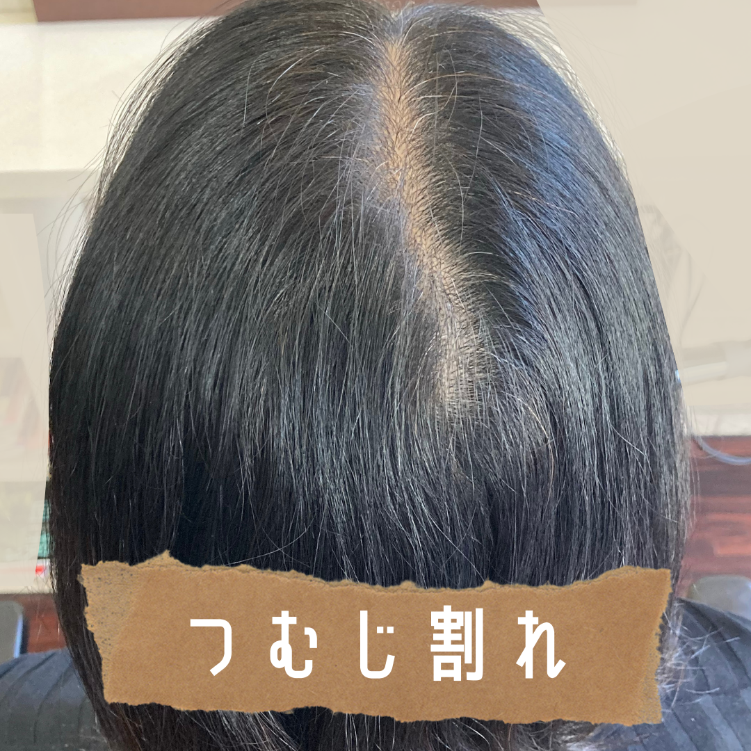 20220705141610