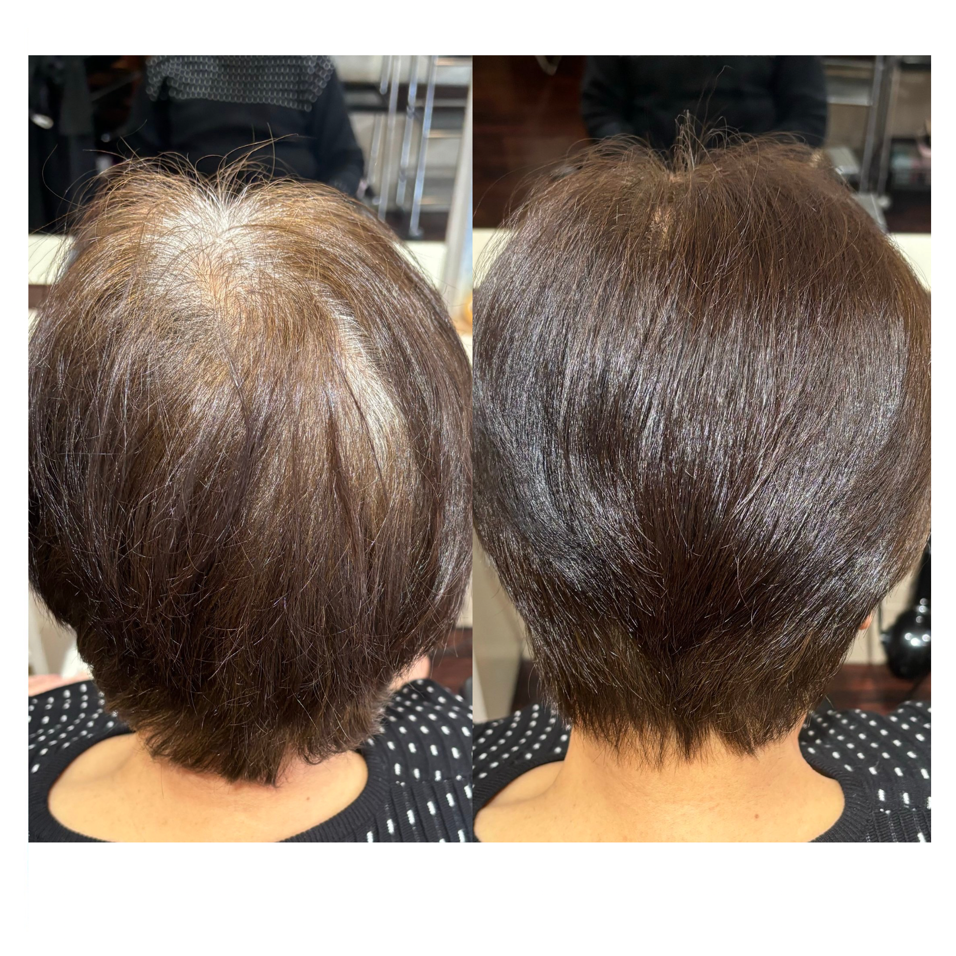 Before After
